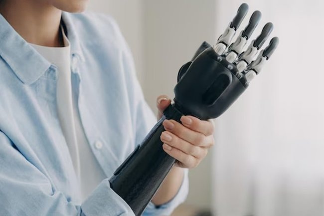 Трансплантация рук в России стала частью системы ОМС