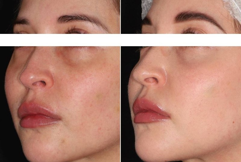 Результат комплексной работы над качеством кожи