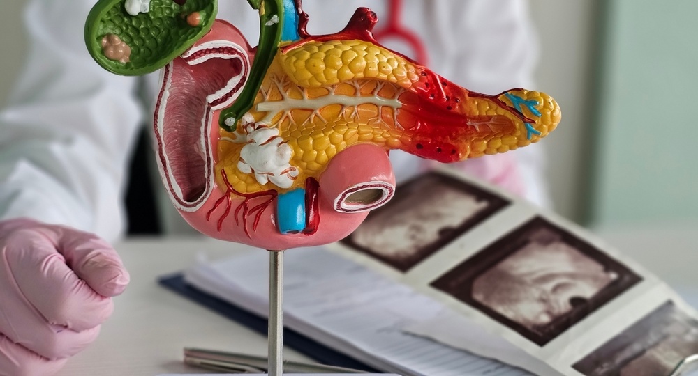 Два новых препарата могут изменить лечение рака поджелудочной железы