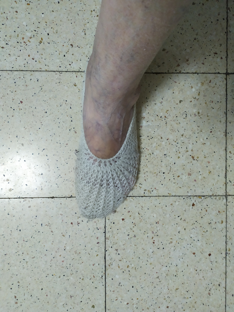 Это шерстяные следочки