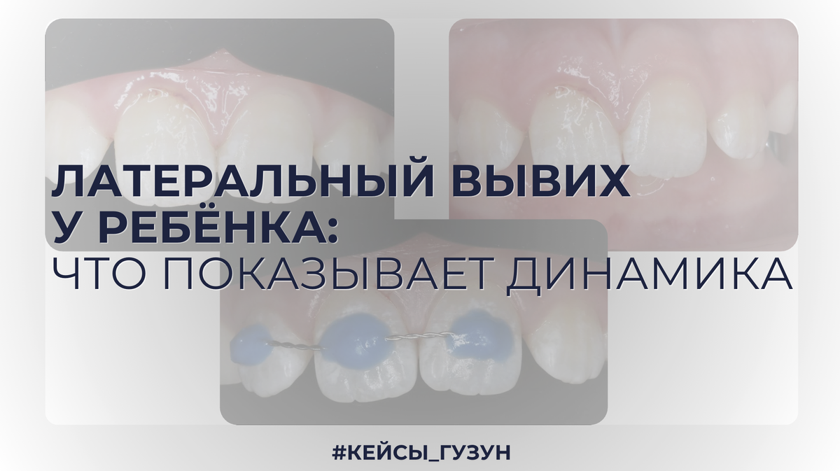 Листайте вправо