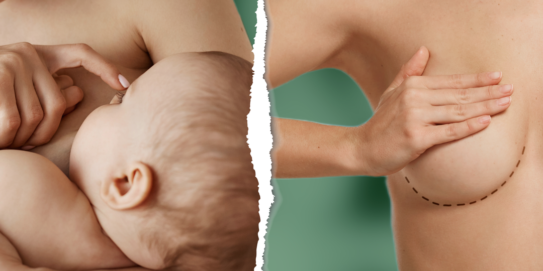 Операция на грудь: до или после родов? Отвечает пластический хирург