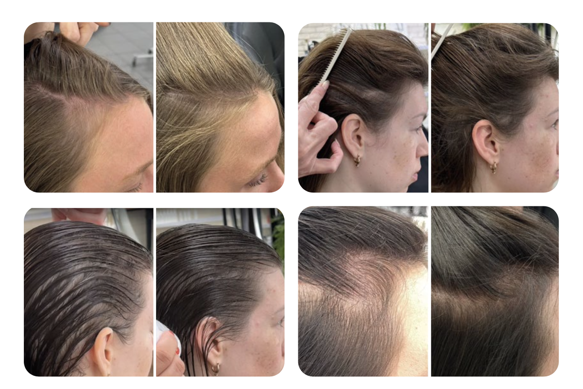 фото «до-после» наших клиентов, которые прошли курс ухода за кожей головы и волосами