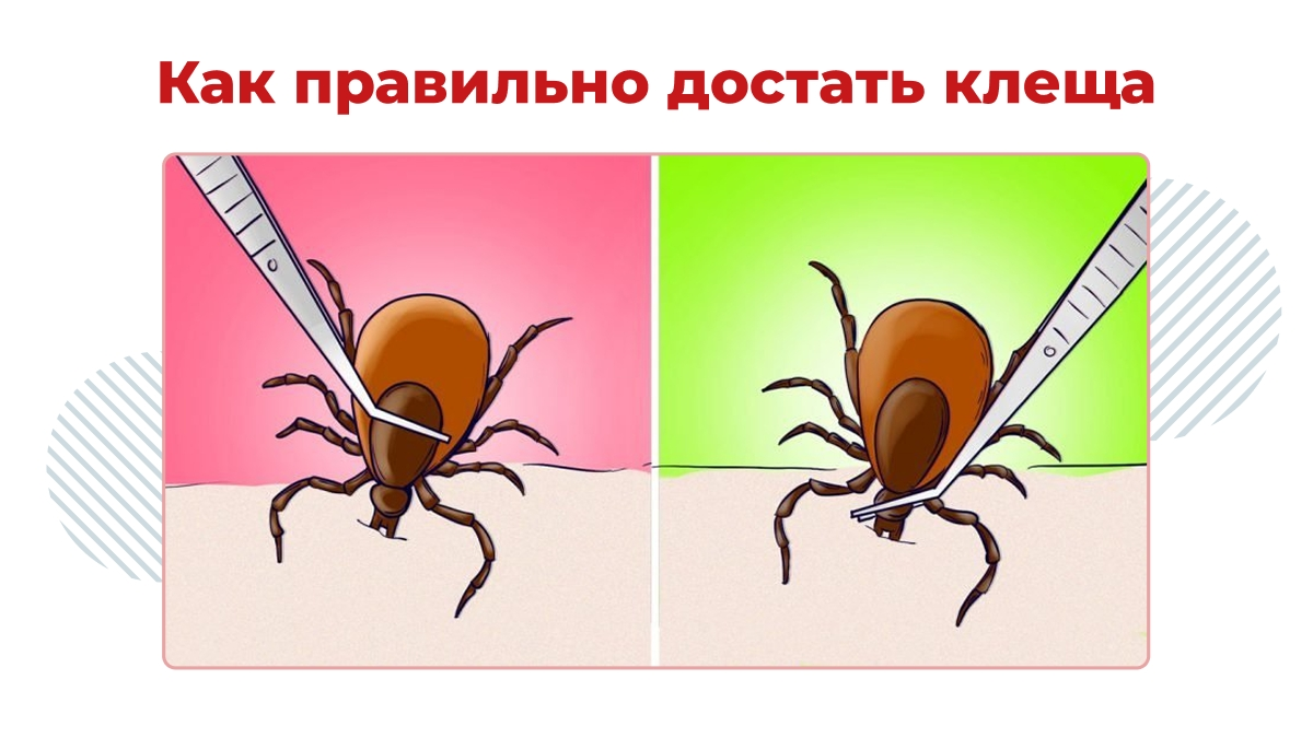 Слева пример неправильного захвата пинцетом. Так клещ будет раздавлен, а его головка скорее всего останется в коже. Справа пример, как нужно правильно ухватиться