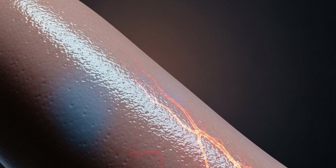 Как понять, что сосуды в плохом состоянии — первые сигналы