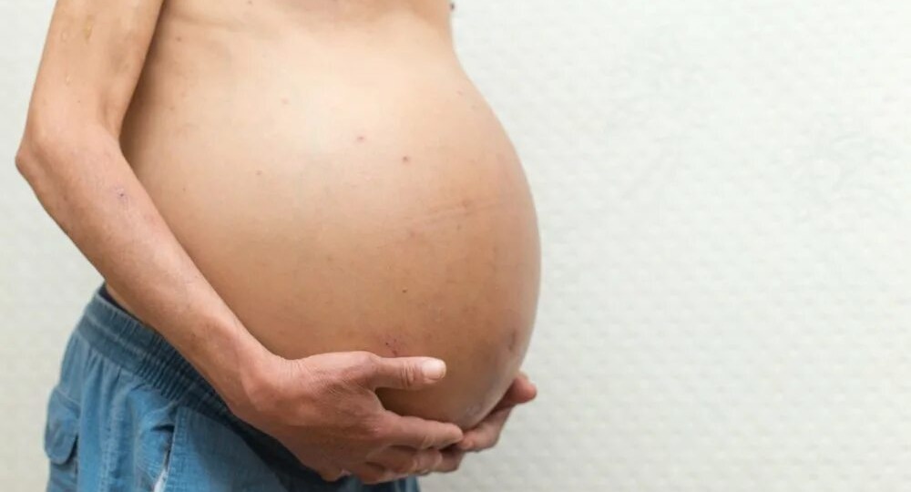 Какие осложнения возникают при раке печени (асцит, желтуха, печеночная недостаточность)?