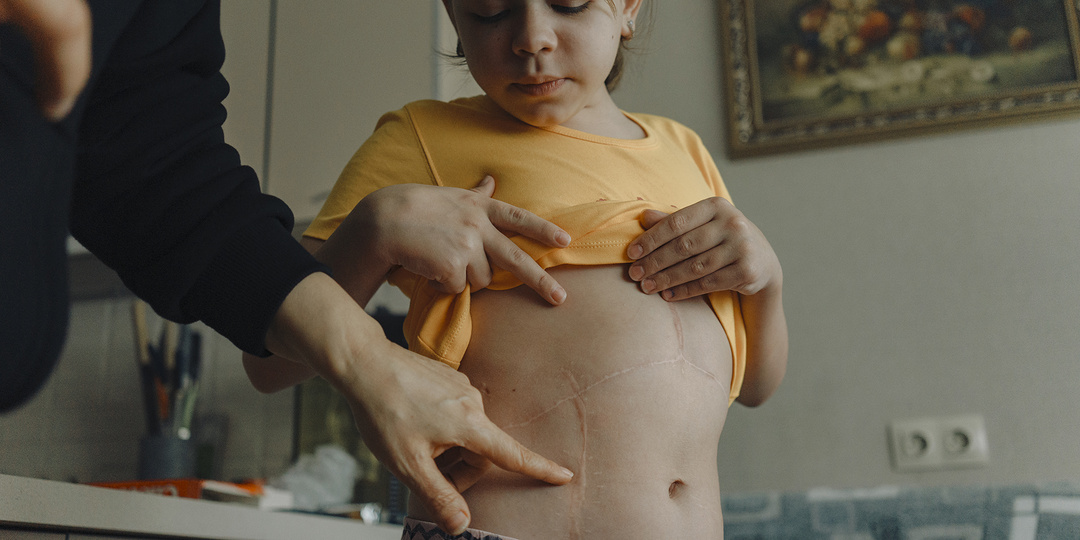 Почки для дочки: у Анжелики три дня рождения, и у ее мамы тоже три, еще у обеих не только общая кровь, но и почки и печень