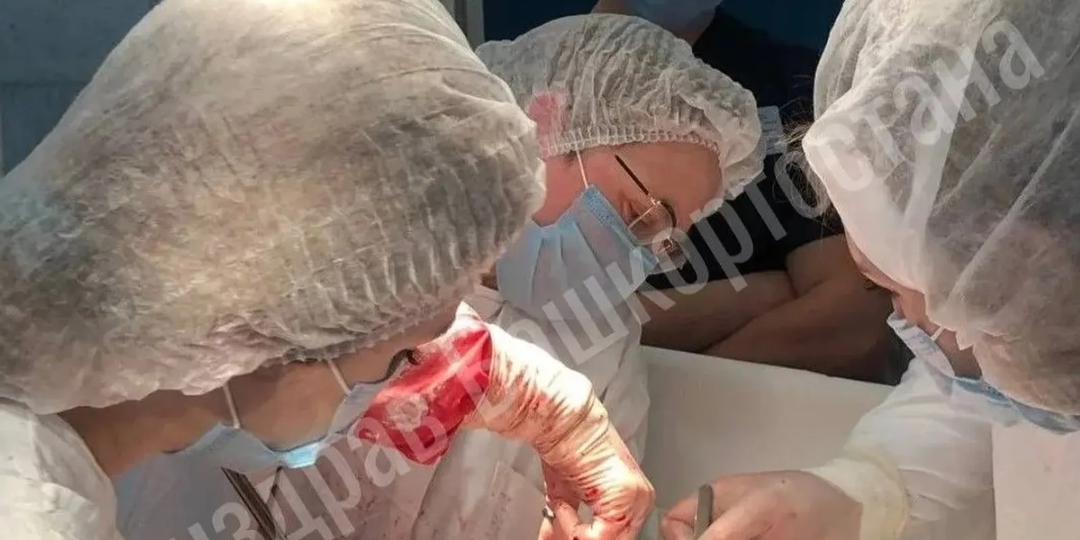 В Башкирии врачи удалили у пациентки гигантскую миому матки