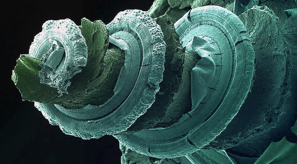   Dr. David Furness / Wellcome Collection / CC BY-NC 4.0