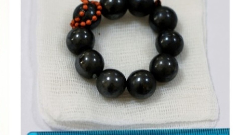 В Барнауле врачи спасли мальчика, проходившего с 10 магнитами в желудке два дня