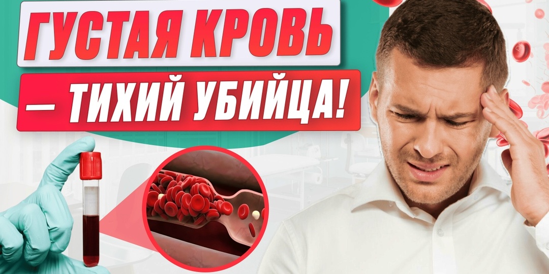 7 признаков густой крови, о которых не говорят в поликлинике