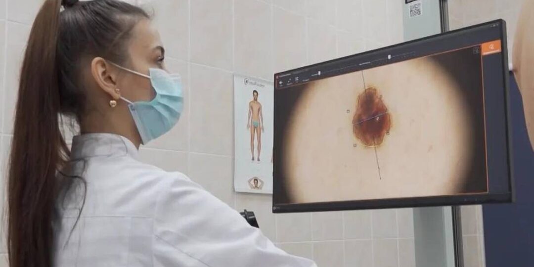 Брянский кожвендиспансер подвел итоги работы кабинета профилактики рака кожи