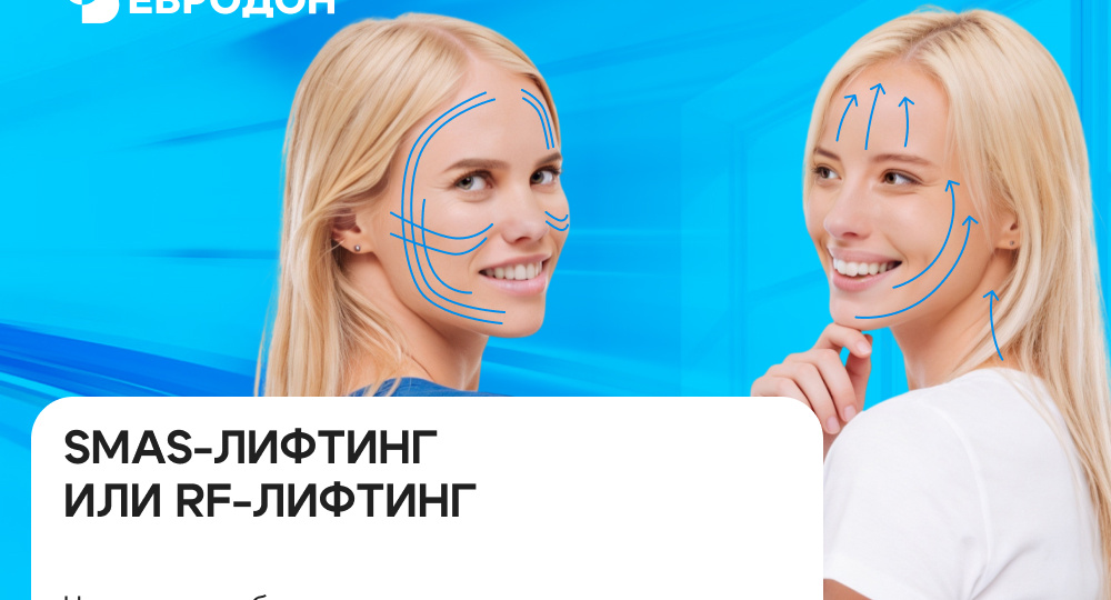 SMAS-лифтинг или RF-лифтинг: что лучше выбрать для омоложения лица