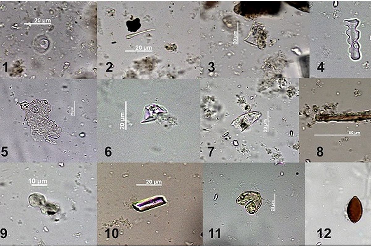    Примеры микроостатков, обнаруженных в зубном камне погребенных в Быстровском некрополе. / РАН