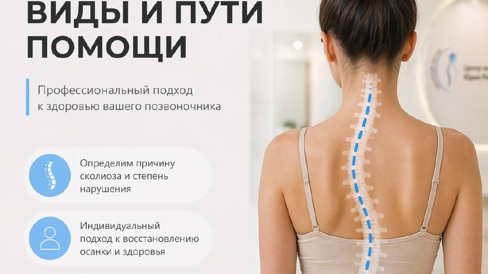 СКОЛИОЗ