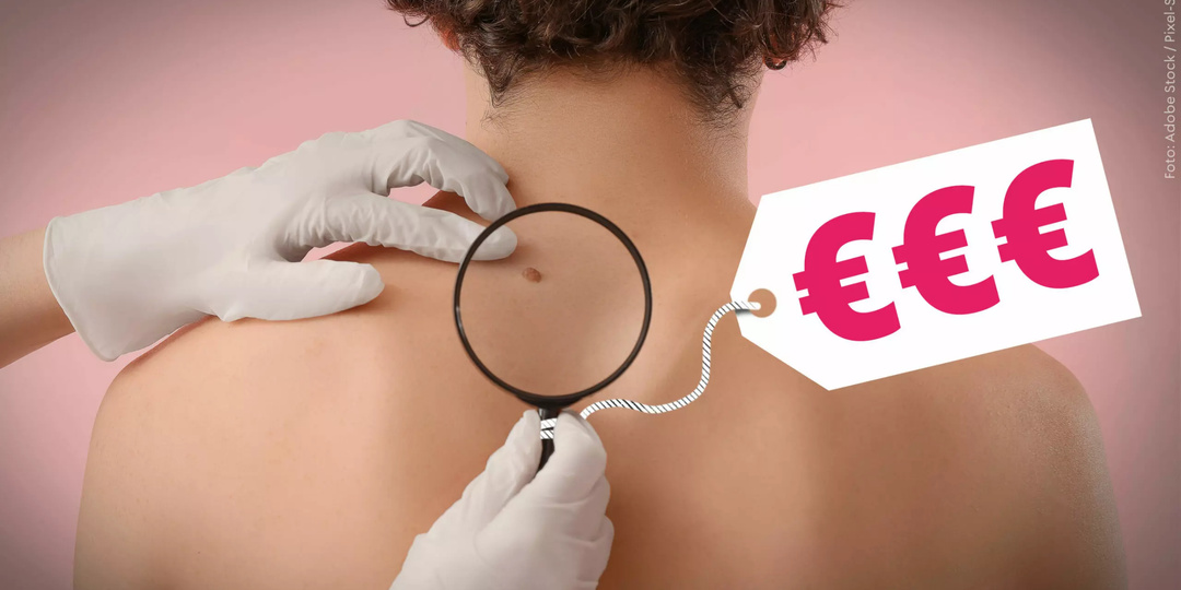 Скрининг на рак кожи находится на грани отмены: специалист рассказывает, кому необходимо проходить обследование ежегодно