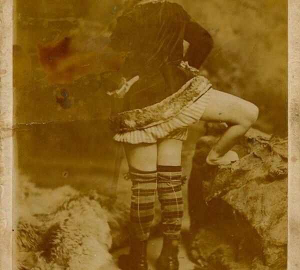 Как он жил с третьей ногой и п были ли у него дети? Судьба трехногого артиста