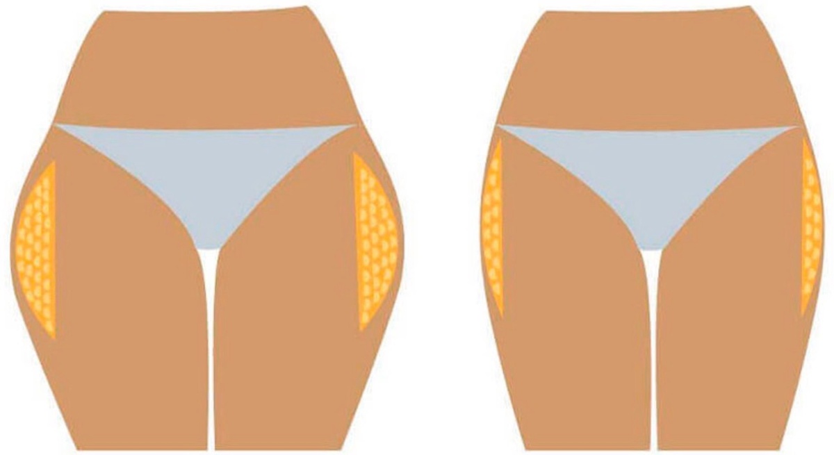 фото из открытого источника