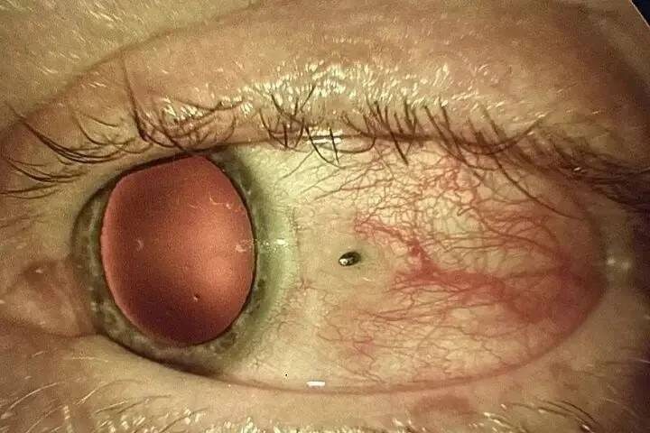    Источник фото: ККБ №2 Владивостока