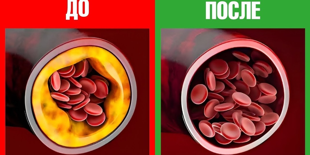 6 продуктов, которые чистят сосуды лучше таблеток