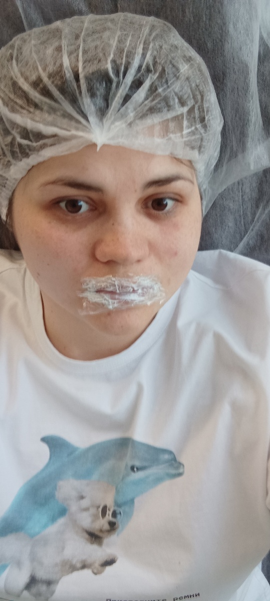 Лидокоин на губах