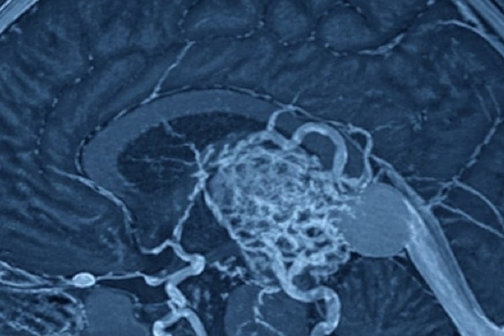 Трехдневного малыша из Нижнего спасли питерские врачи