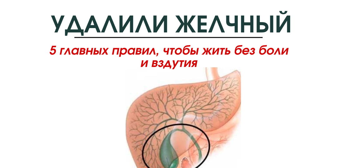 Удалили желчный: 5 главных правил, чтобы жить без боли и вздутия