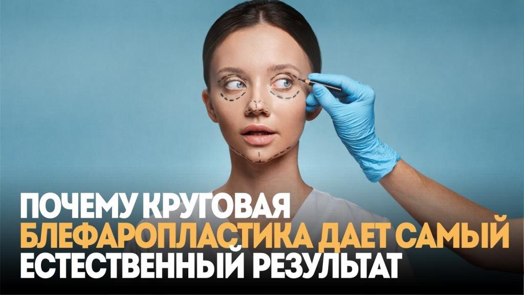 Почему круговая блефаропластика дает самый естественный результат 