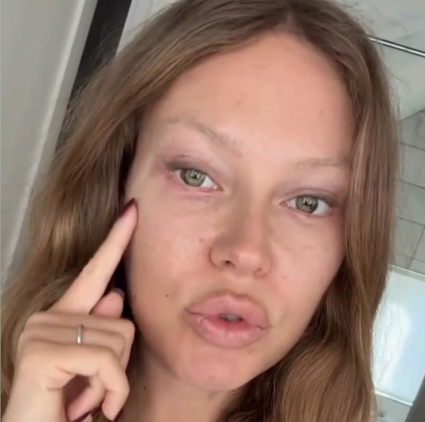 -2