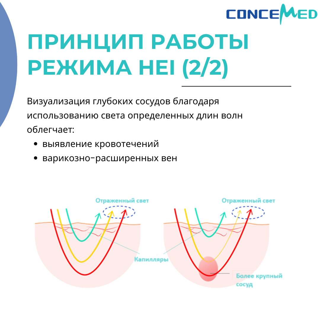 Специальный световой режим HEI Concemed
