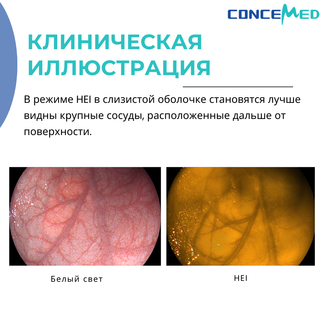 Специальный световой режим HEI Concemed