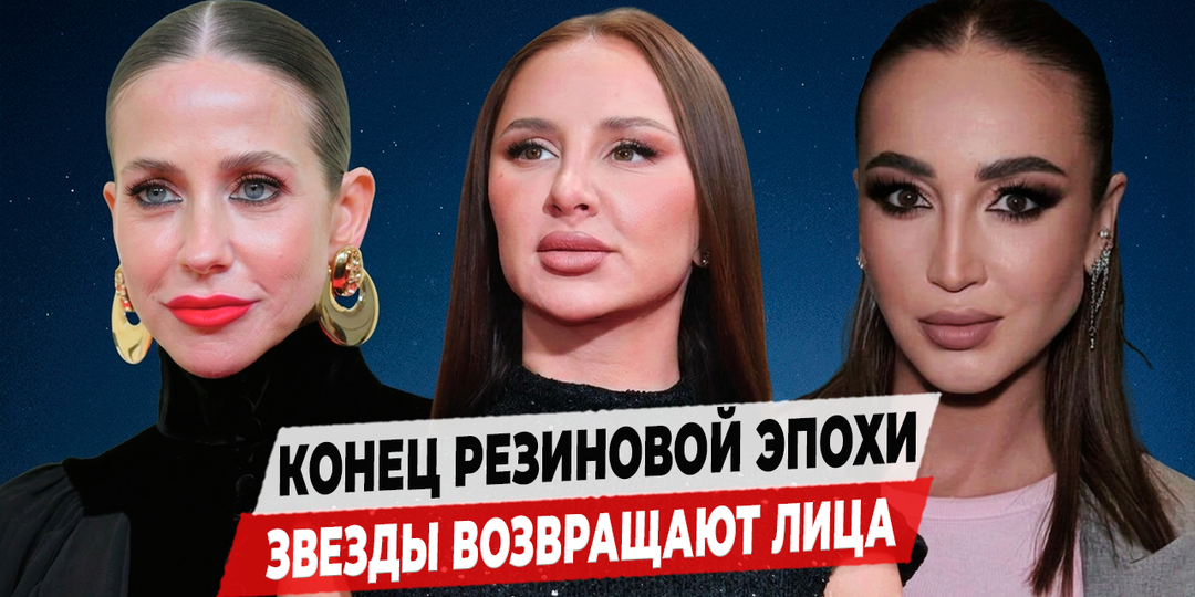 Звезды массово удаляют филлеры: почему губы-вареники больше не в моде
