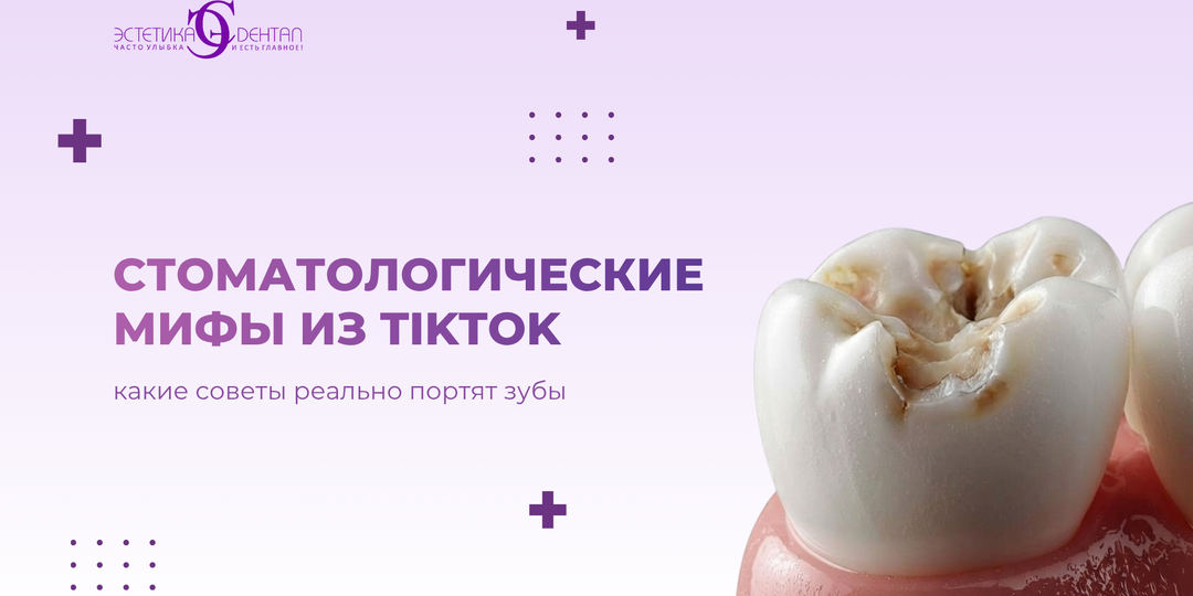 Мифы из TikTok, которые портят зубы