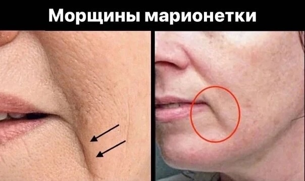 Фото из открытых источников интернета 