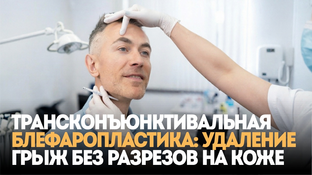 Трансконъюнктивальная блефаропластика: удаление грыж без разрезов на коже