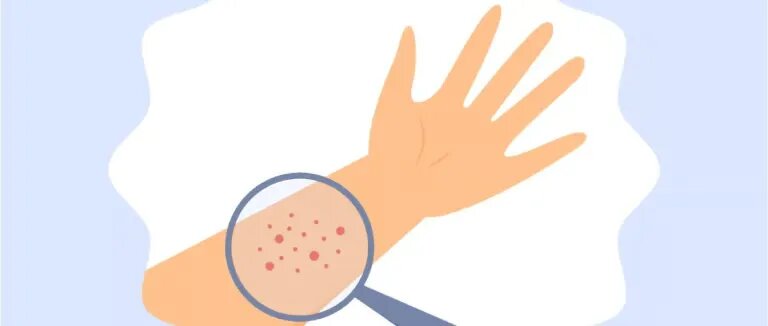 Кожа как второй мозг: болевая память, язык прикосновений и сила изменений