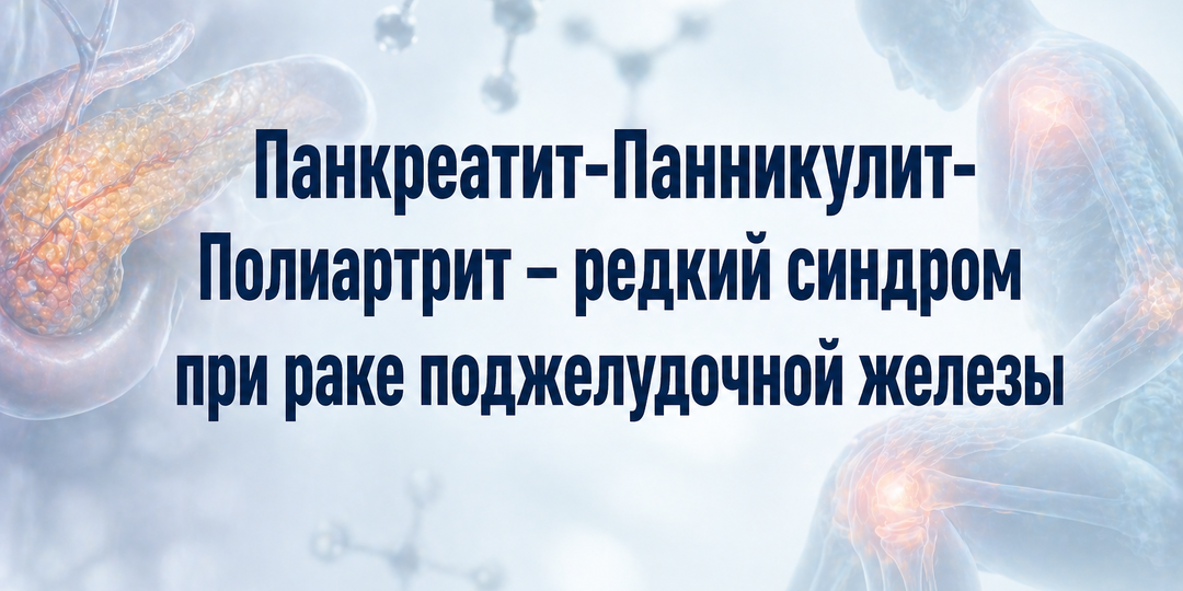 Панкреатит-Панникулит-Полиартрит – редкий синдром при раке поджелудочной железы
