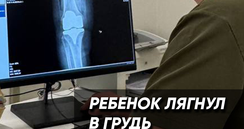 Ребенок лягнул в грудь? Перелом мечевидного отростка: редкая травма, о которой нельзя молчать