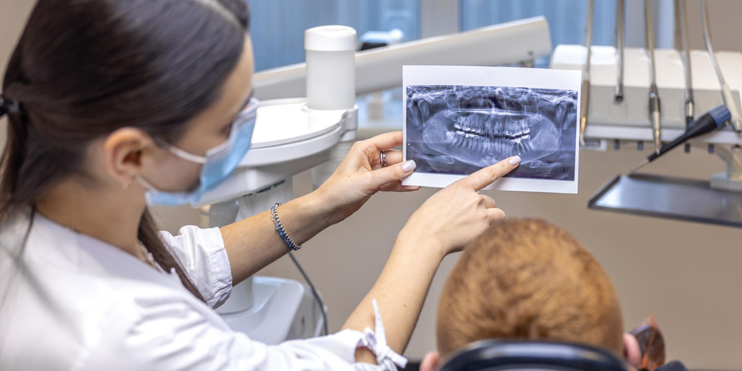 Выбили зуб? Не паникуйте: у вас есть около часа, чтобы спасти улыбку