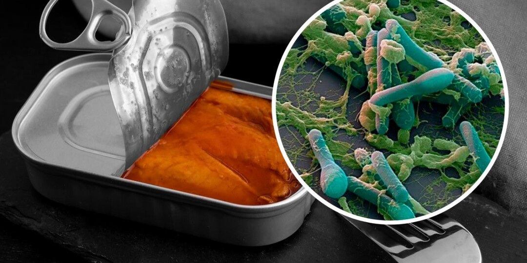 Что такое ботулизм, и с чем его едят: первые симптомы, и поможет ли нам водка?