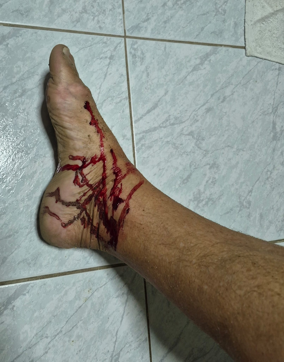 Рвали на куски... 