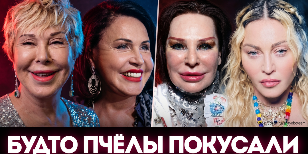 Будто пчелы покусали: почему наши и зарубежные звезды стали похожи друг на друга?