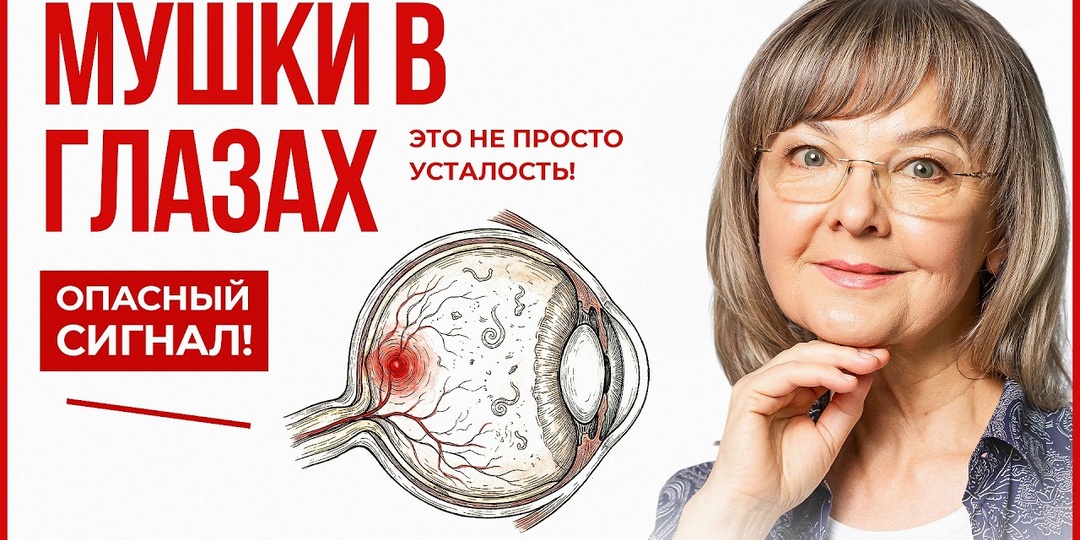 Почему «мушки» перед глазами — тревожный сигнал