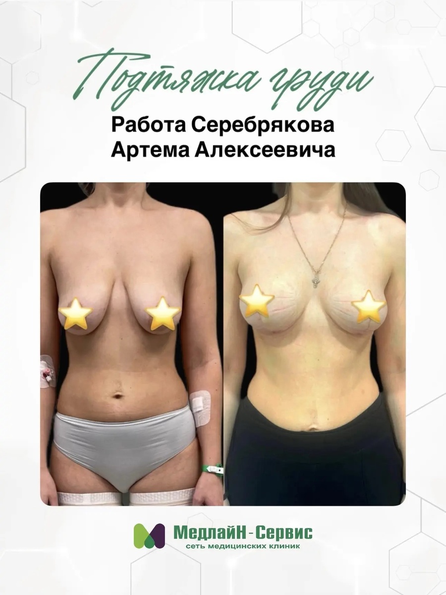 Результат ДО/ПОСЛЕ