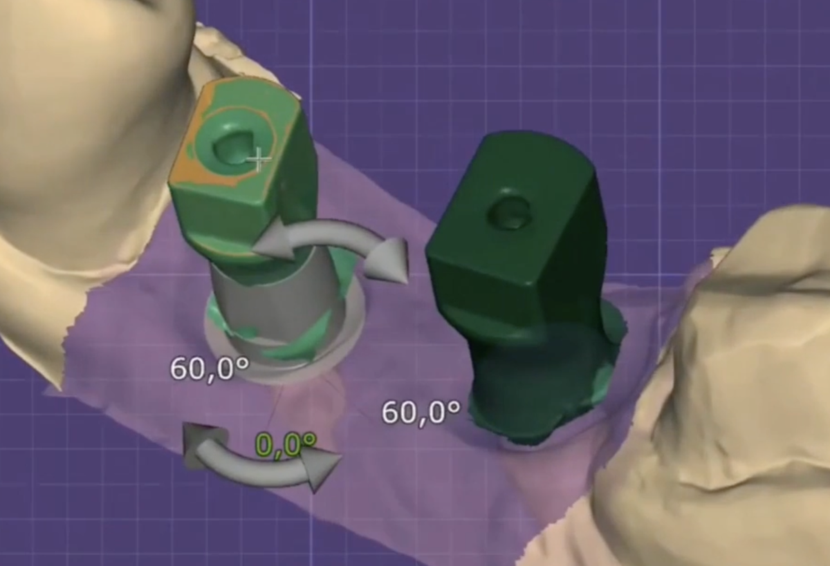 -2
