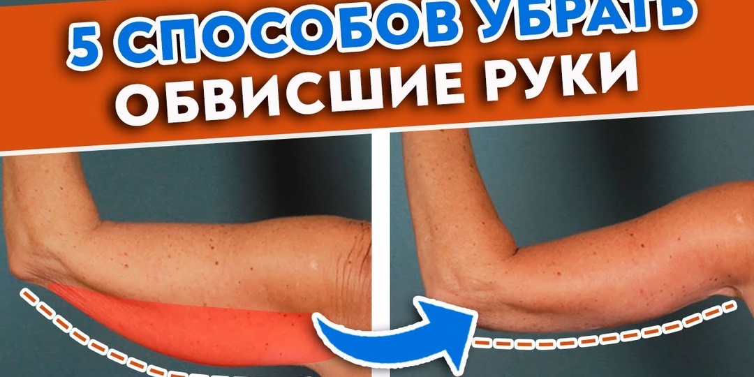 Как подтянуть дряблые руки 5 способов убрать обвисшую кожу на руках