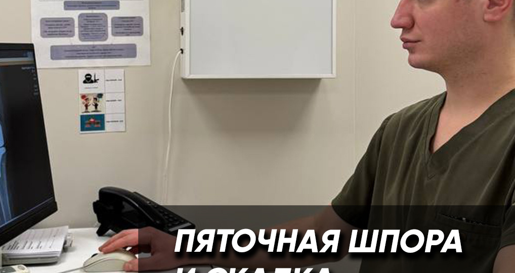 Пяточная шпора и скалка: почему вы делаете только хуже?