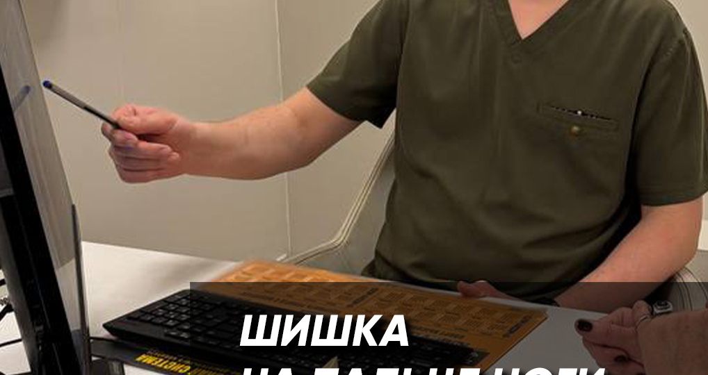 Шишка на пальце ноги — это не «косточка выросла». Разбираем три главные причины