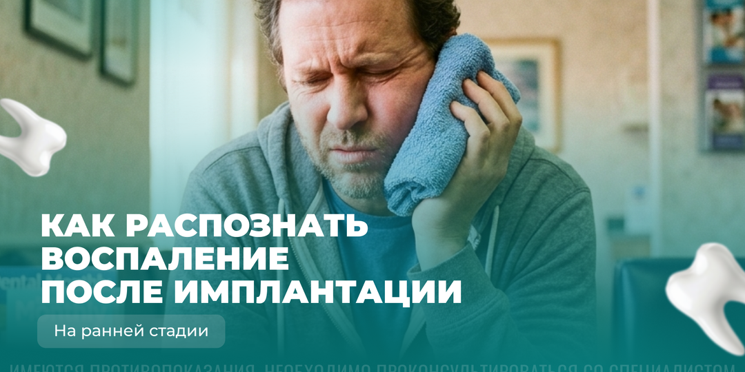 3 тревожных сигнала после имплантации: как не пропустить воспаление и спасти новый зуб