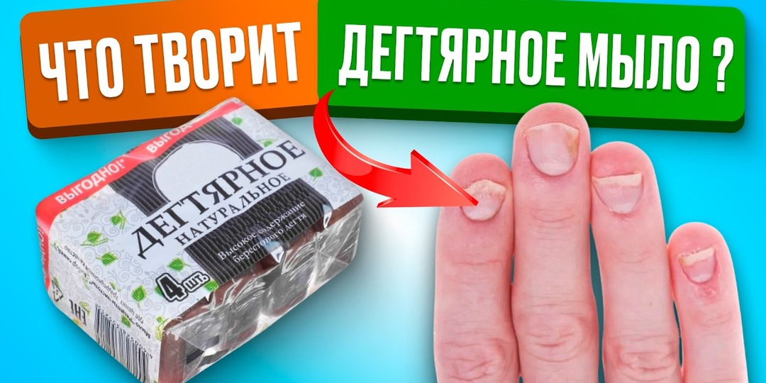 90 % не знают об этом. Это МЫЛО спасает от целого букета недугов